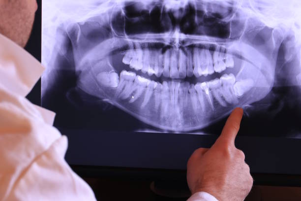Best Emergency Tooth Extraction in San Marino, CA
