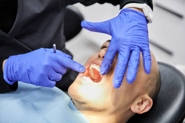 Best Emergency Treatment for Dental Infections or Abscesses in San Marino, CA