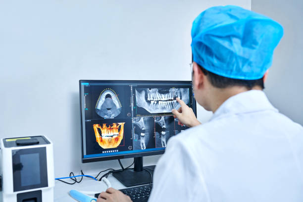 Best Emergency Dental Care for Broken or Chipped Teeth in San Marino, CA